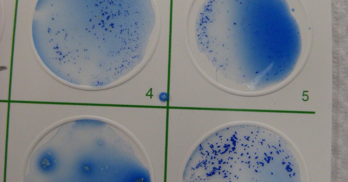 DVC Microbiology 146 Fall 11 (Gard) Lab 30 Staphylococcus aureus