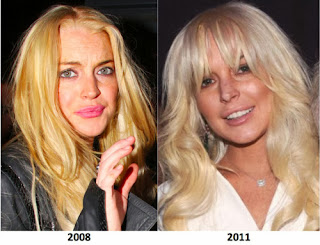 Coco Austin Plastic Surgery Before and After Photo