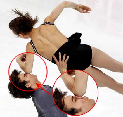 Figure Skating Accidents