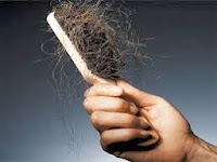 ¿Hay una manera de detener  la caída del cabello genética?