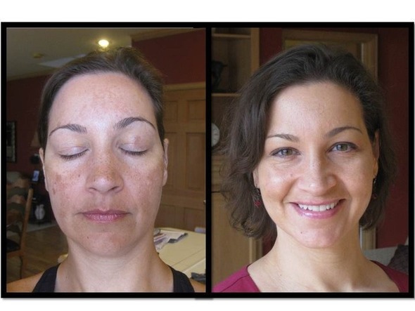 Rodan Fields Reverse