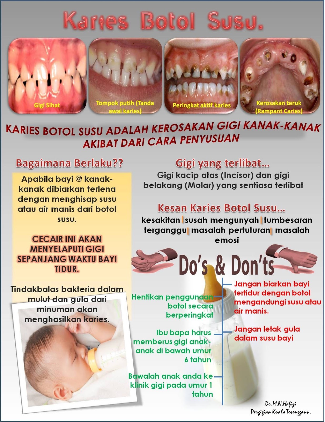 Poster Karies Gigi Sketsa