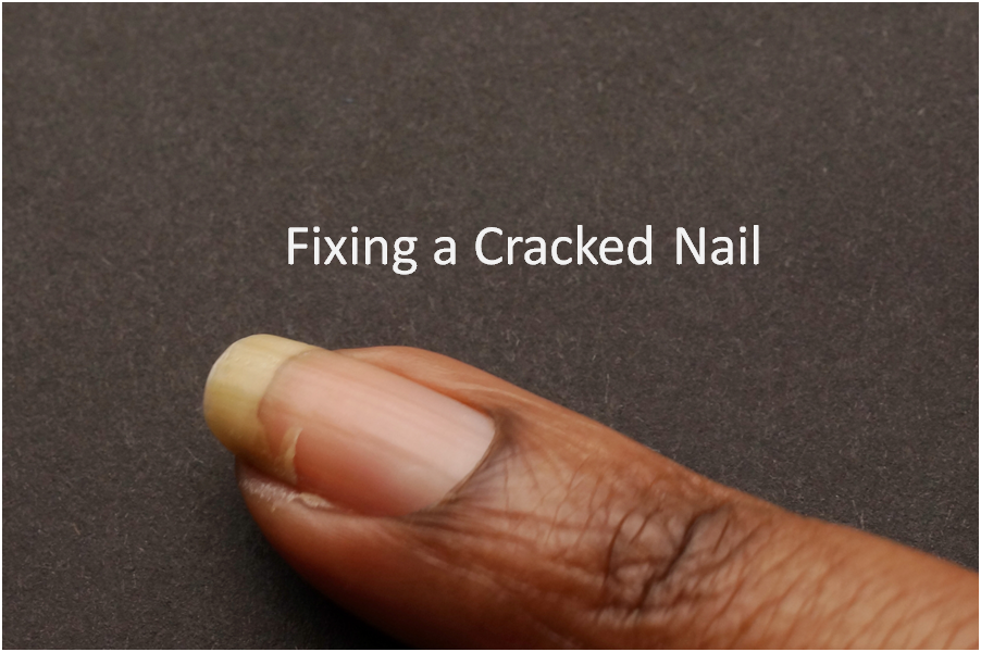 The Nail Polish Shark Fixing a Cracked Nail