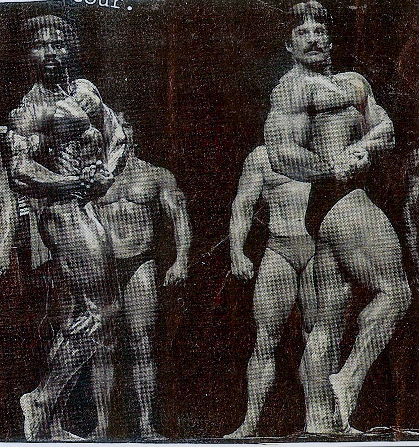 Muscle Separation