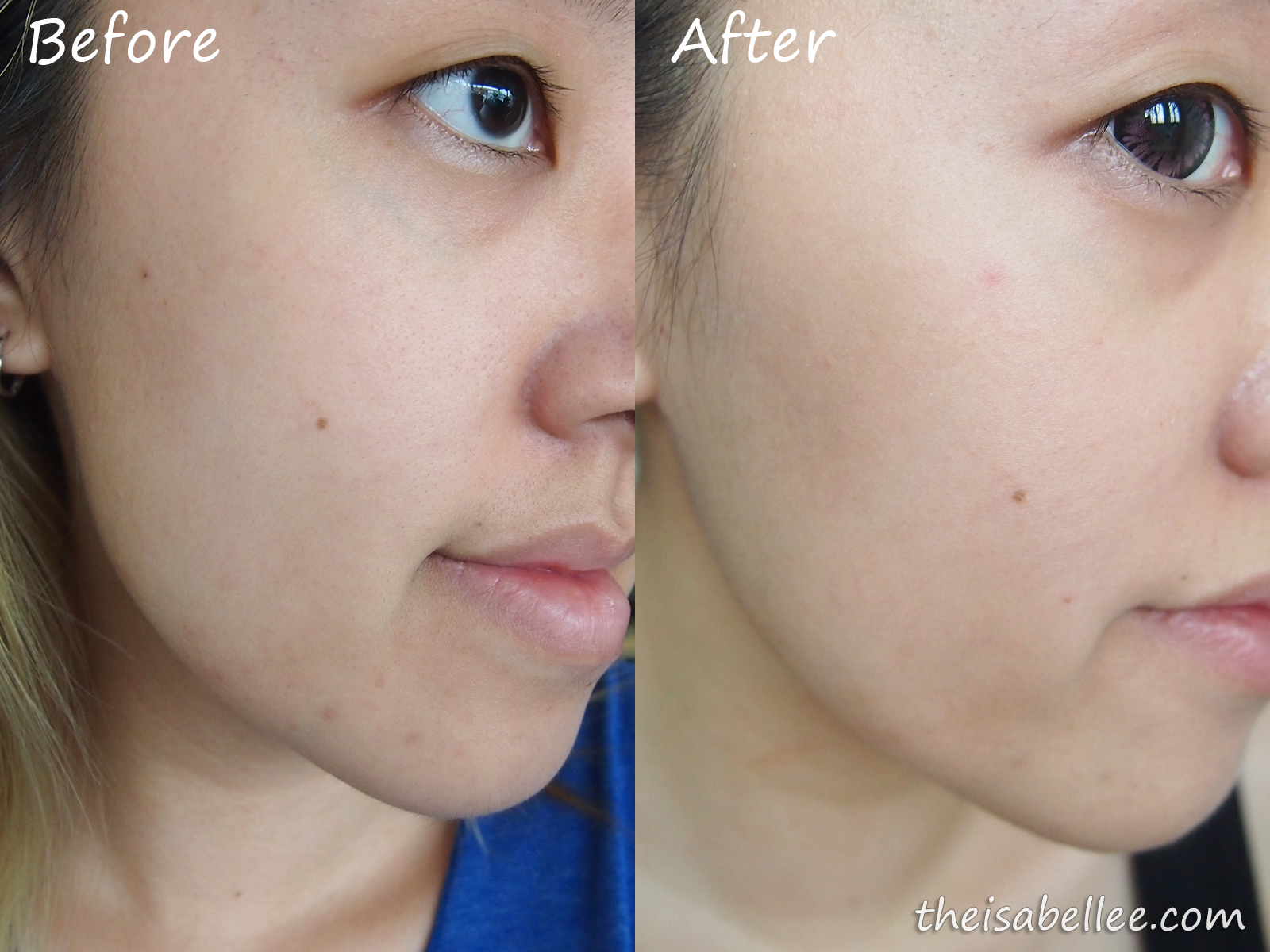 Results from using La Belle skincare