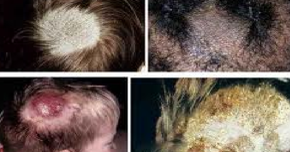 definition of blight definition of blight