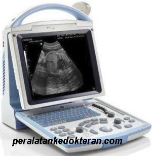 Mindray-DP10-Ultrasound.jpg