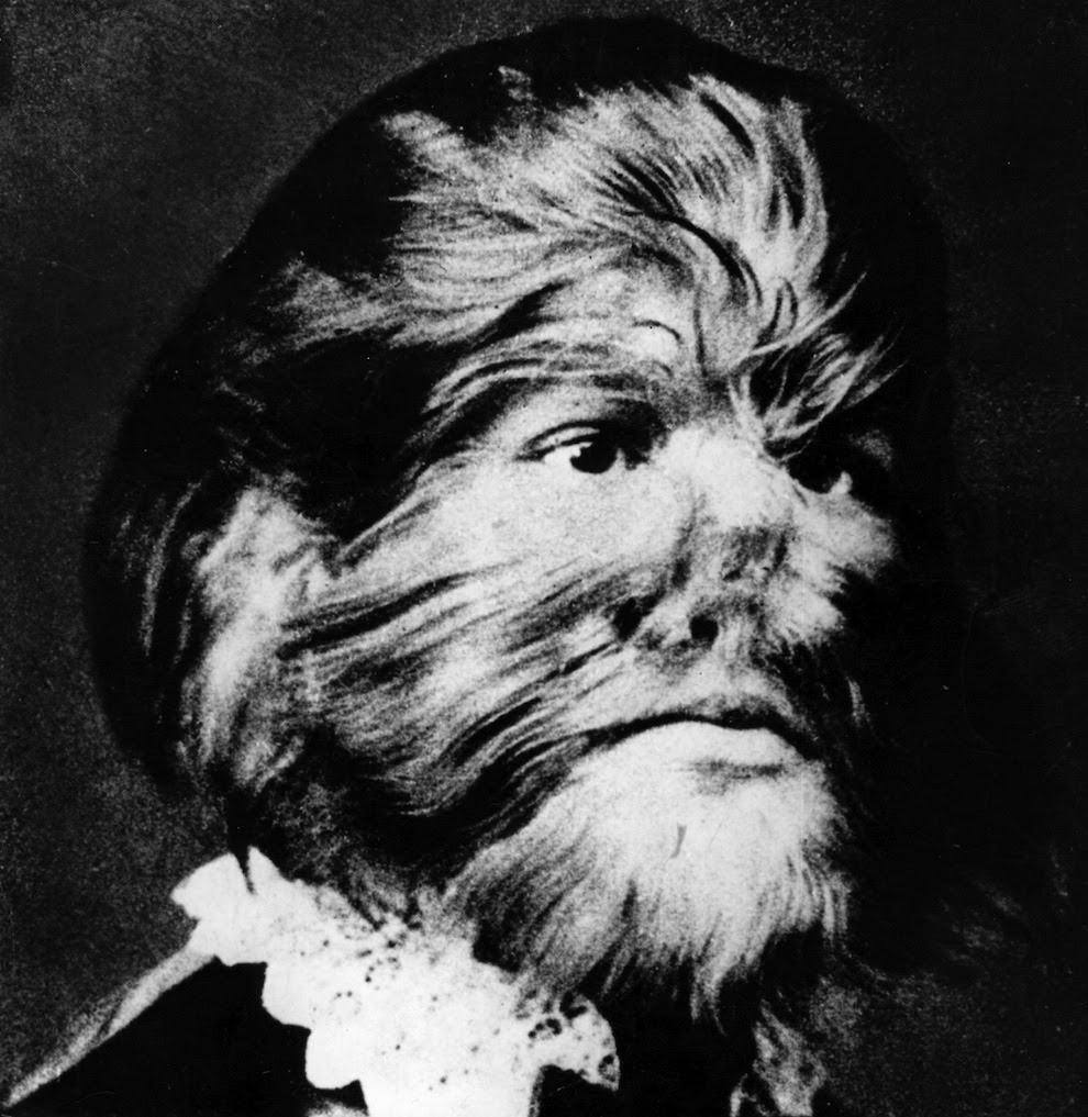 Unbelievably Haunting Vintage Photos from The Circus vintage everyday