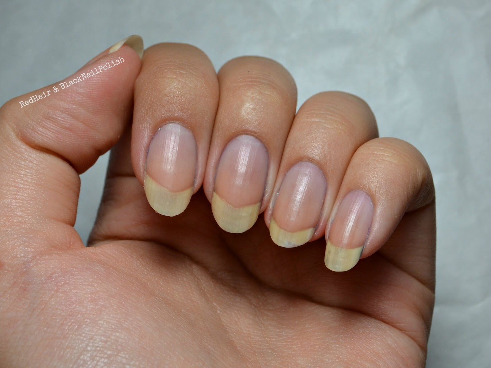 Why Are My Fingernails Peeling Off In Layers