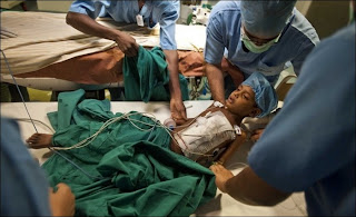 Fetus In Fetus, Parasitic Twin, Deepak Paswan
