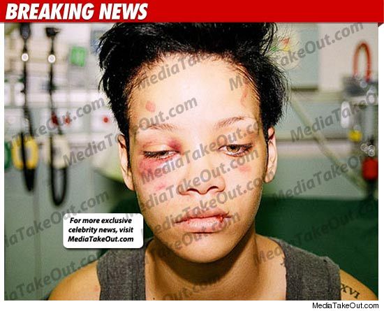 New Beaten Rihanna Picture rihanna pics leaked by chris brown. New Beaten Rihanna Picture
