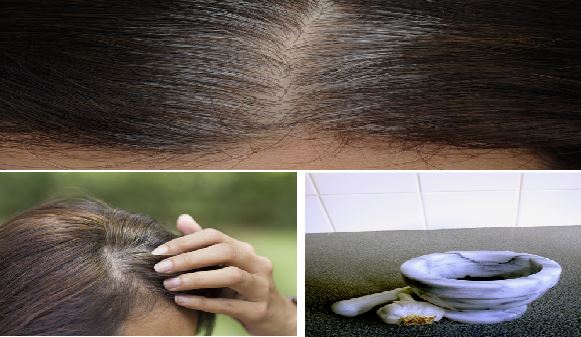 5 Minutes To Get Rid Of White Hair And Regrow Hair Naturally