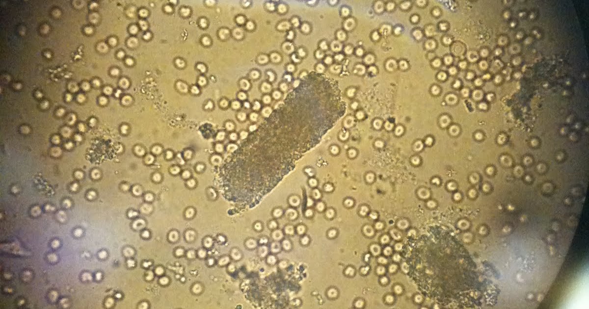 Renal Fellow Network Urine Microscopy and the Camera Phone