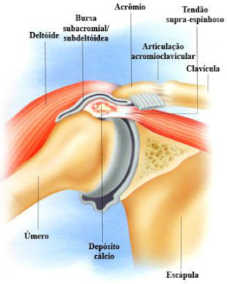 Reabilitação relacionada à articulação do Ombro Reabilitação da articulação do ombro envolvendo Tendinite Calcária
