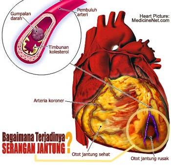 Kesehatan Jantung Puskesmas Piyungan