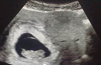 Alien Face Appears In Mother’s Womb – Ultrasound Reveals Strange Visage; An Ancient “Vampire” And Other Haunting Images 16