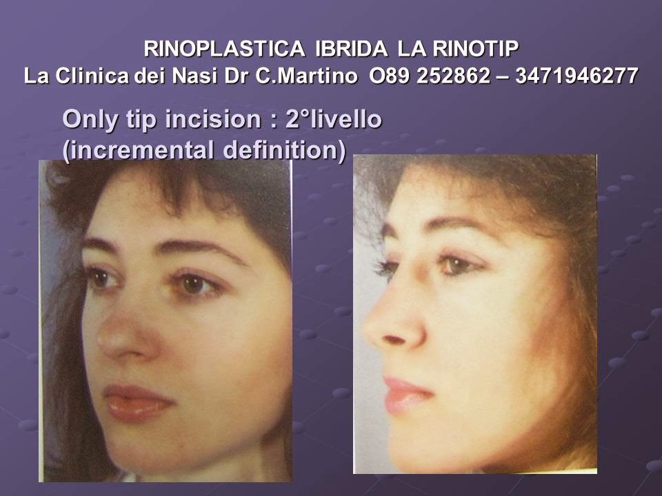La Clinica Dei Nasi Dr Martino Salerno Febbraio 15