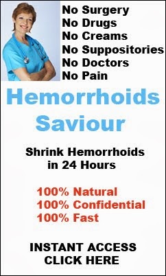 How to Shrink Hemorrhoids Naturally