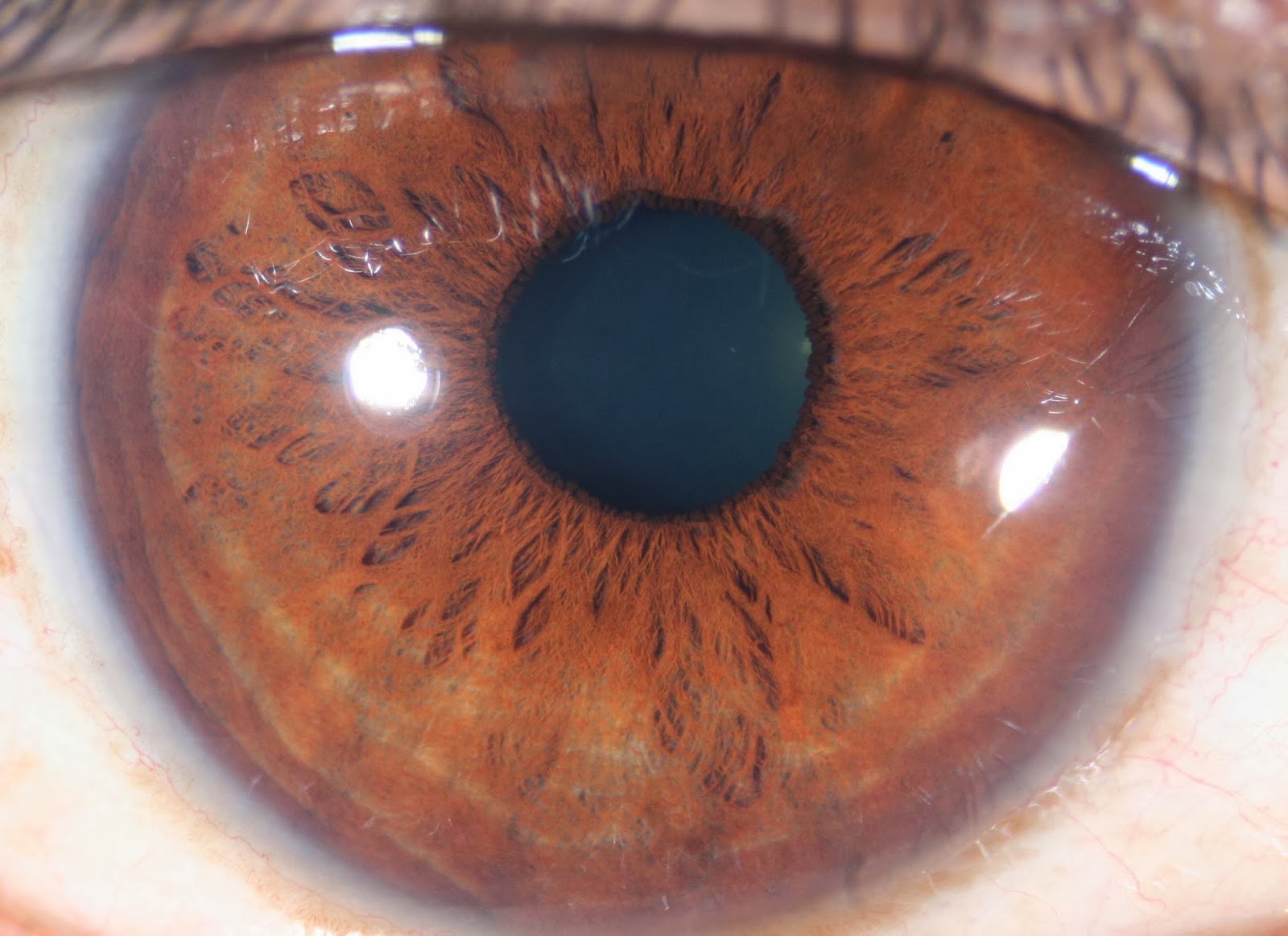 Modern & Multidimensional Iridology The Inner Pupillary Border