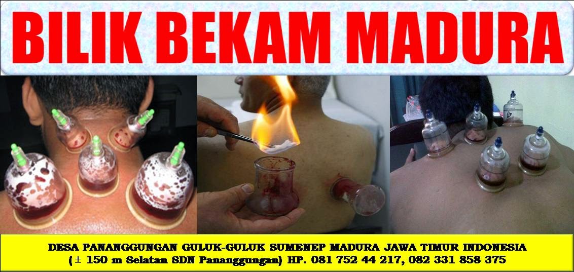 BILIK BEKAM MADURA