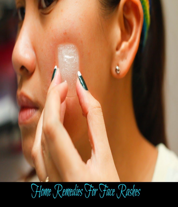 Home Remedies For Face Rashes Tips Park