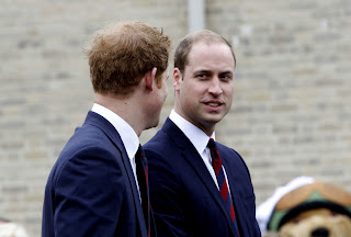 Prince Harry going bald?