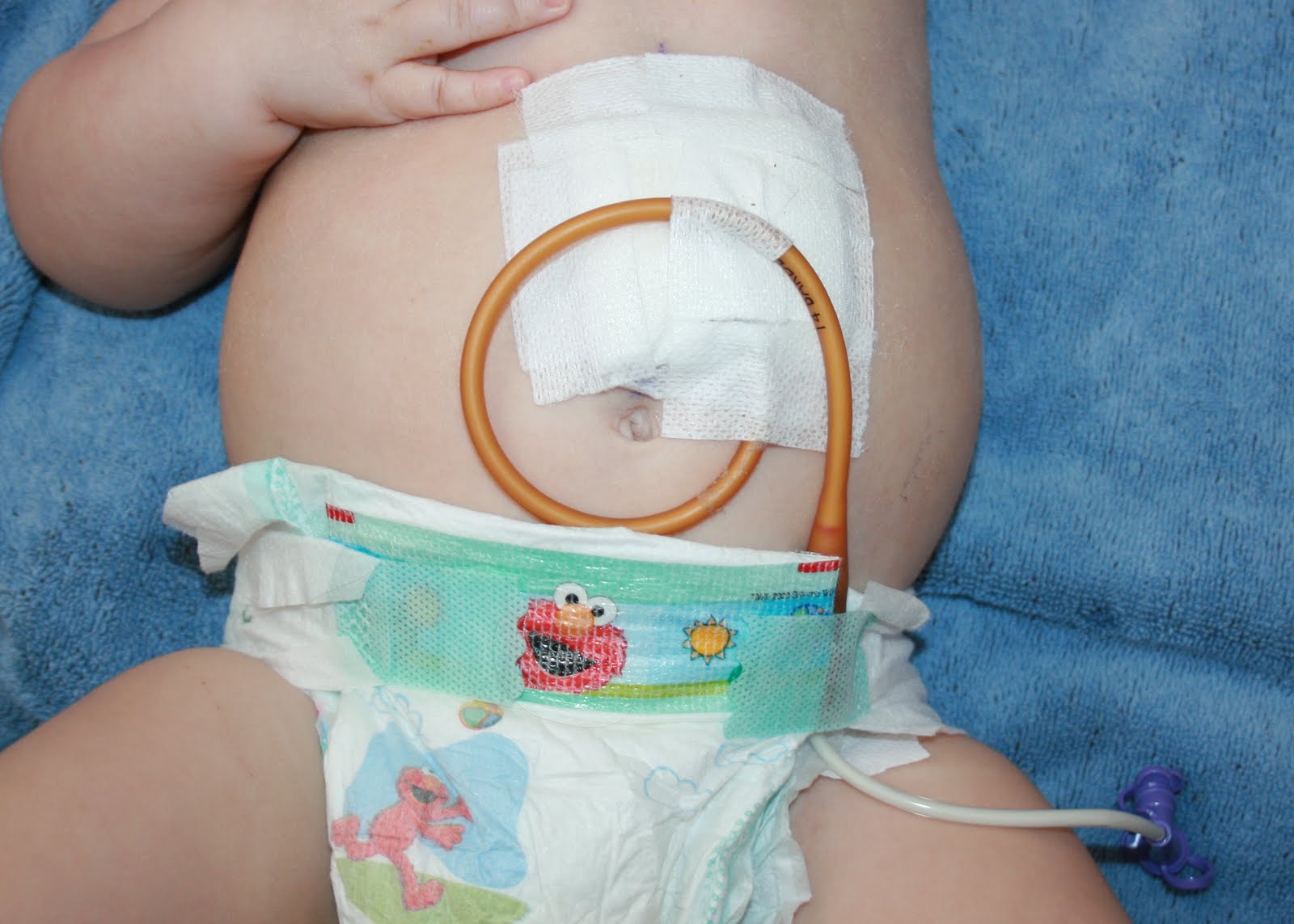 A Story Of Two Moms GTube Placement