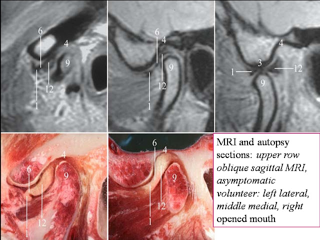 TMJ+5.jpg