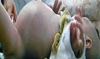 Η κοιλιά αυτού του μωρού άρχισε να φουσκώνει...  Όταν μάθαμε την αιτία σοκαριστήκαμε!! [βίντεο]