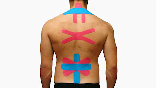 Kinesio Taping: uma forma de combater a dor na coluna