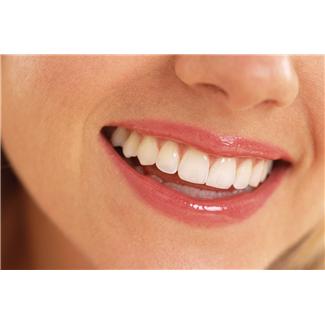 Equate Teeth Whitener