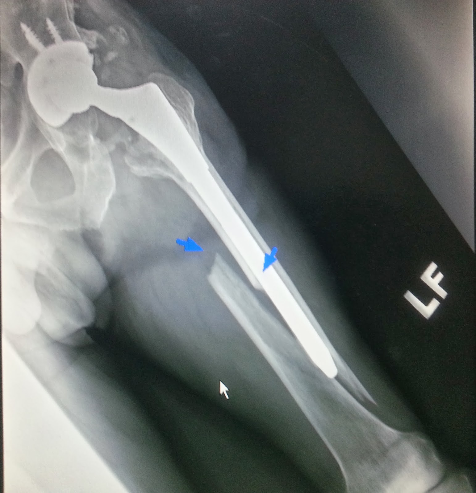 鍾承翰醫師骨科chen Han Chung M D Orthopaedic Surgeon 一月14