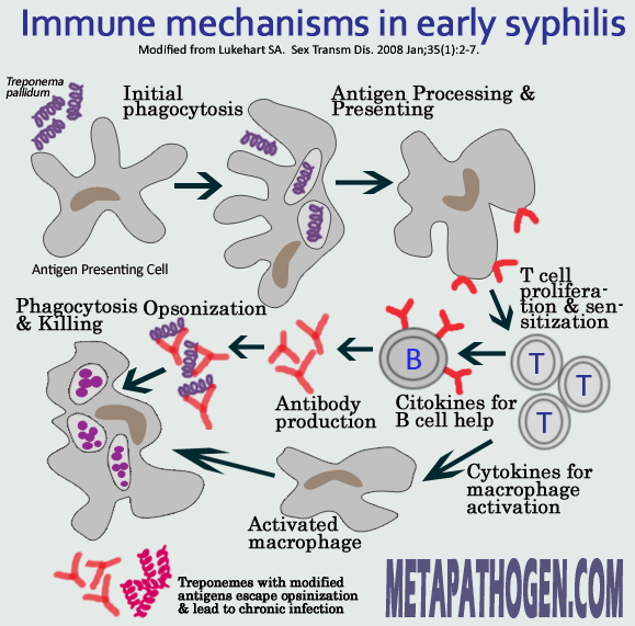 the clinical description of syphilis Secondary syphilis is the second stage of this highly contagious sexually transmitted infection learn about the symptoms and treatment options. the clinical description of syphilis Secondary syphilis is the second stage of this highly contagious sexually transmitted infection learn about the symptoms and treatment options.