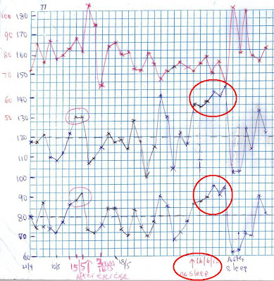 elevated blood pressure chart due to lack of sleep elevated blood pressure chart due to lack of sleep