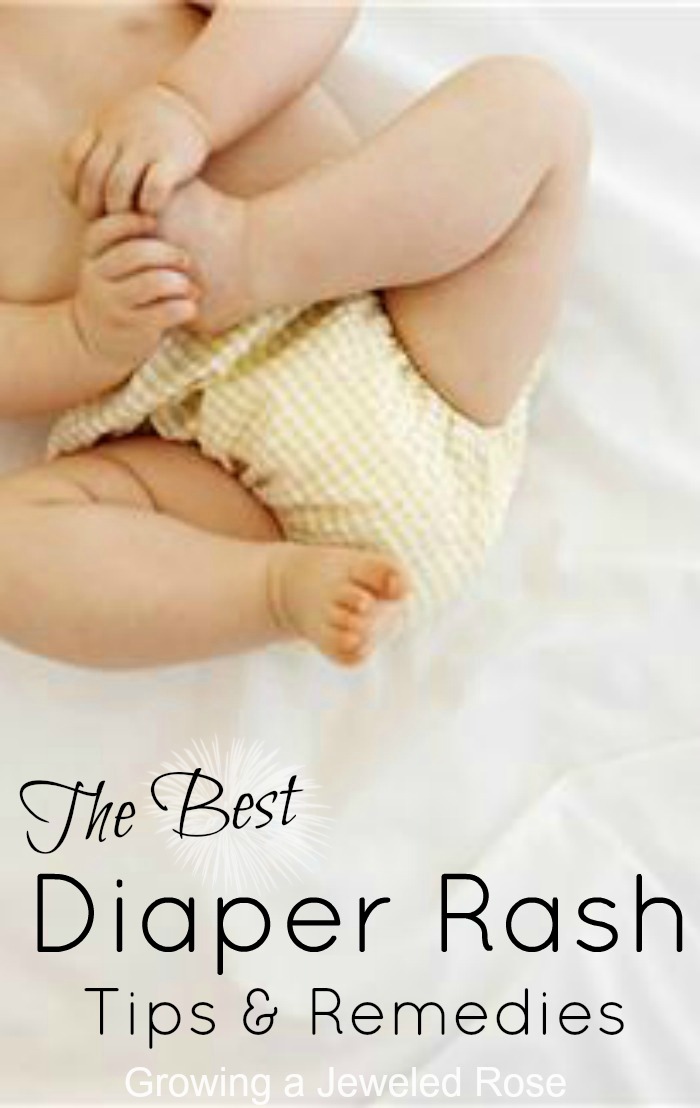 Rash on kids bum