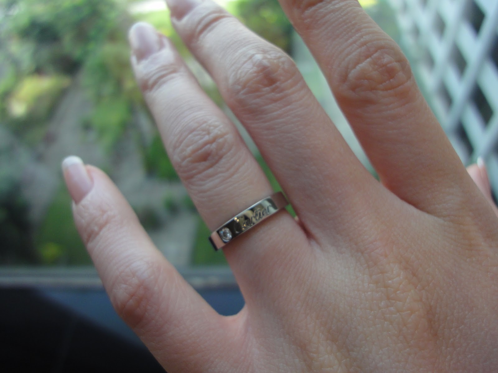Silver Lining Our wedding band Allergic Reactions?