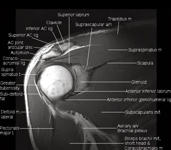 mri anatomy of the shoulder