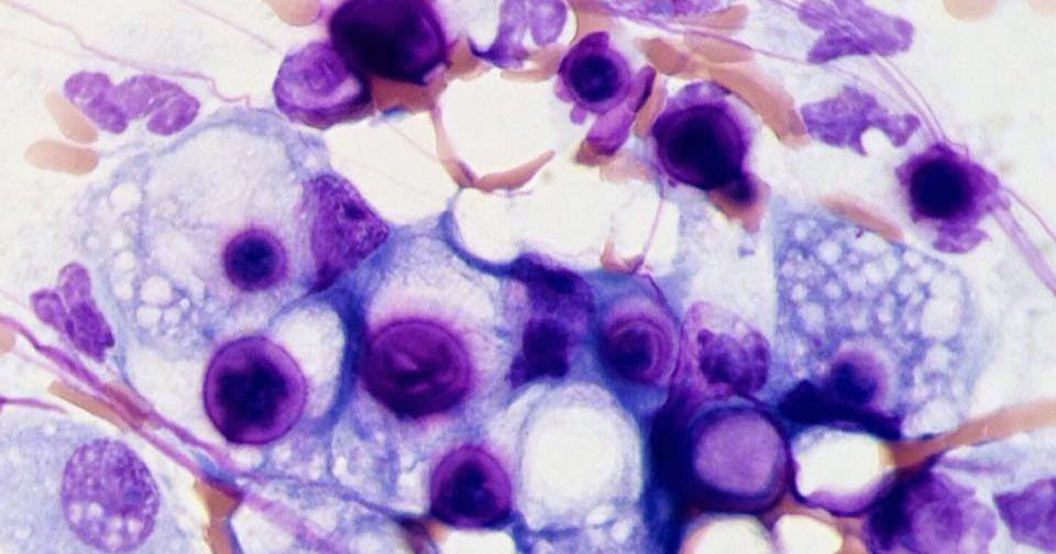 Veterinary Clinical Pathology Cytology Imprint of nasal discharge