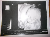 My Liam(: 27 weeks 3D ultrasound