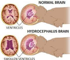 ineffective tissue perfusion nursing diagnosis ineffective tissue perfusion nursing diagnosis