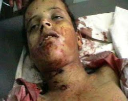 مقتل الطفل عبد السلام علي احمد والشاب جياد محمد بطلقات مباشرة أصابت جسديهما ، بينما أصيب نحو عشرين