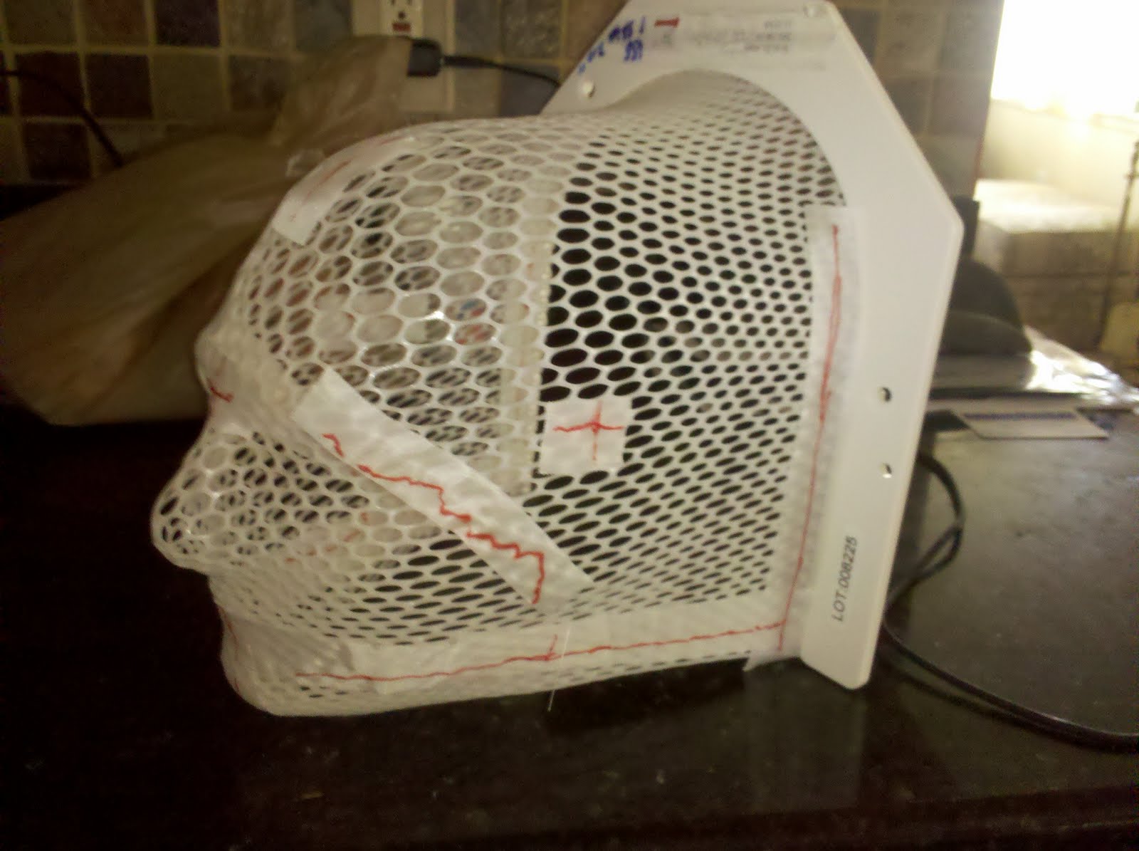 Annie's Cancer Adventure II Whole Brain Radiation 14 Treatments DONE!