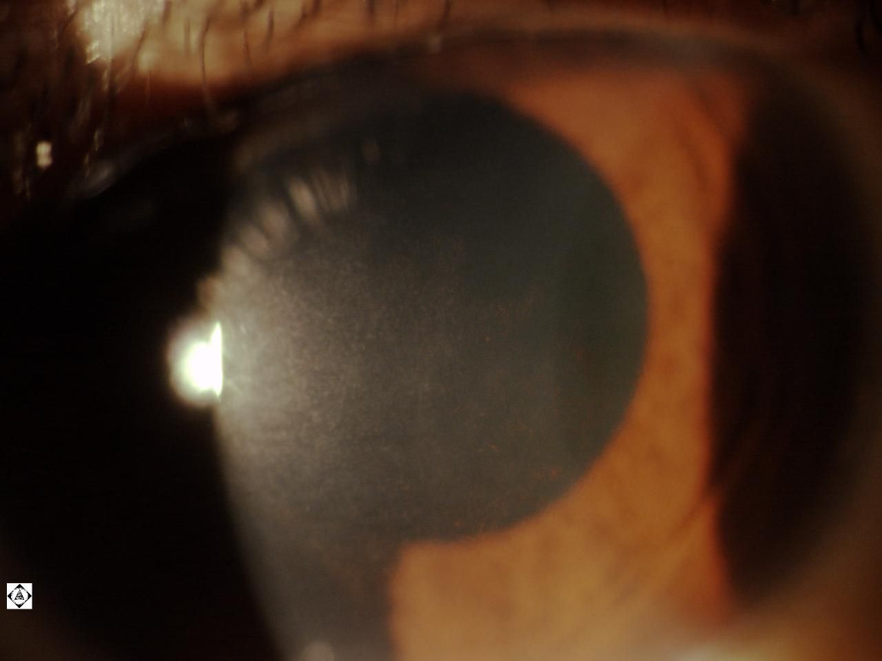 Sonoran Desert Eye Center June 2013