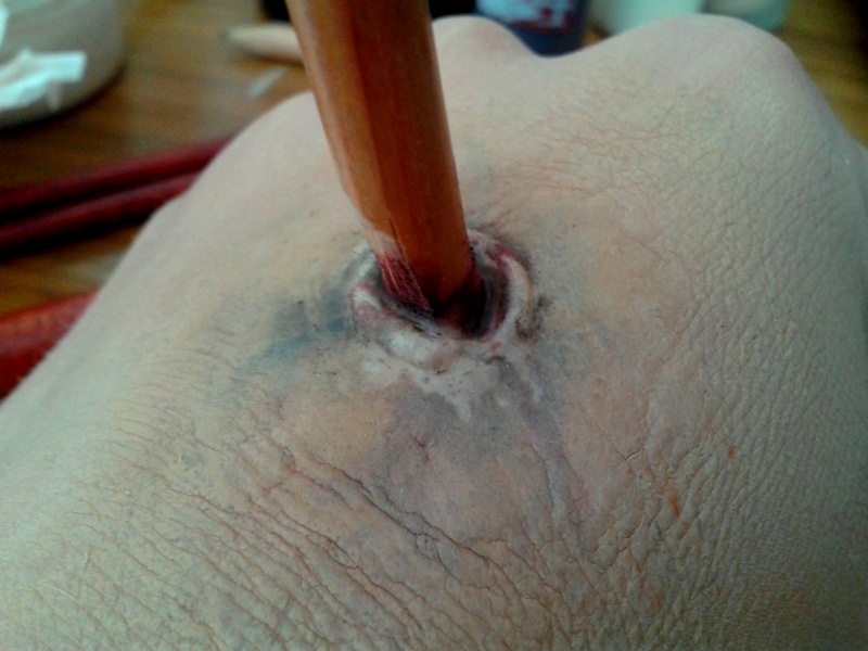 Red Veiny Rash