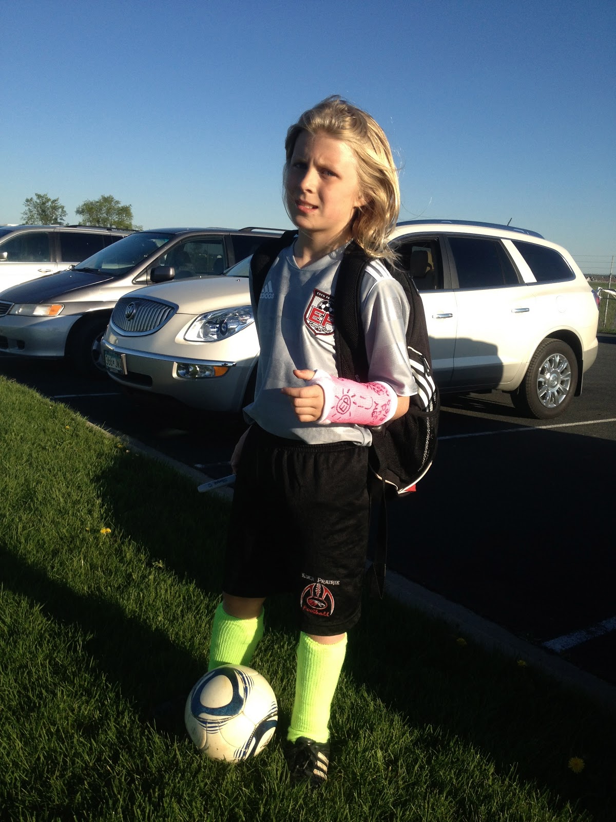 Pergande Family Updates Broken Arm Two Casts