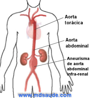 Artéria aorta e aneurisma