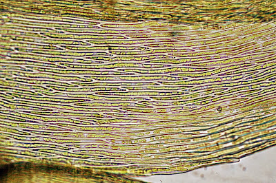 Isoptyerygium tenerum leaf cells