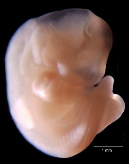 Mamá en tiempos revueltos: Desarrollo del bebé semana 5, 6 y 7 embarazo. Mamá en tiempos revueltos: Desarrollo del bebé semana 5, 6 y 7 embarazo.
