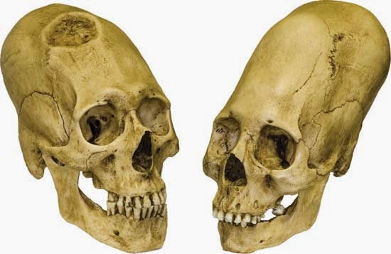 Elongated Skulls! Elongated Skulls!