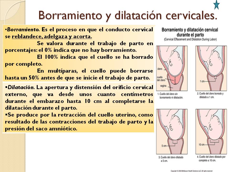Materno-Infantil cbtis 243: El útero en el trabajo de parto.